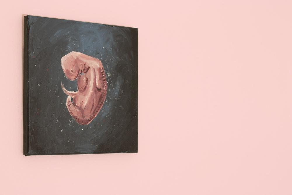 Symbolism and Meaning of Fetus in Dreams